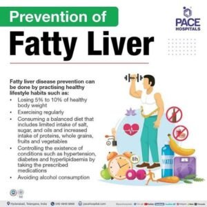 Fatty liver disease 