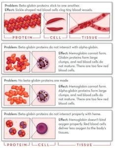 hemoglobin disorders ashrafshahin.com